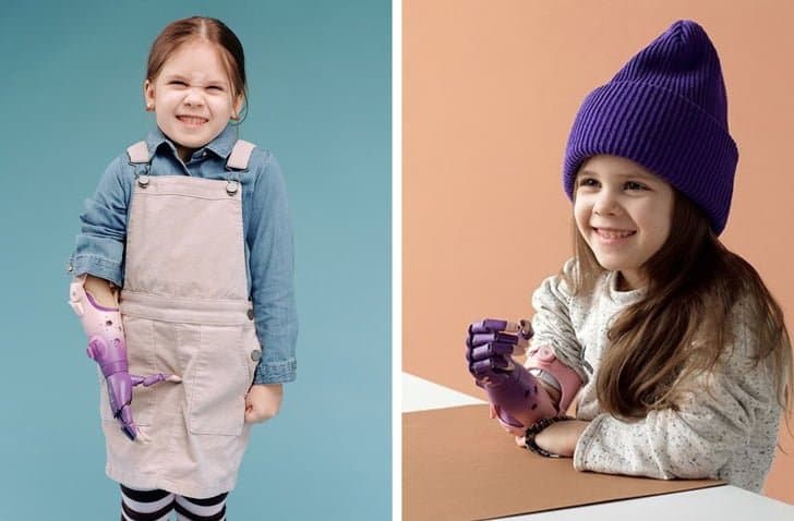 17 фото про те, як доброта і сучасні технології допомагають людям з інвалідністю